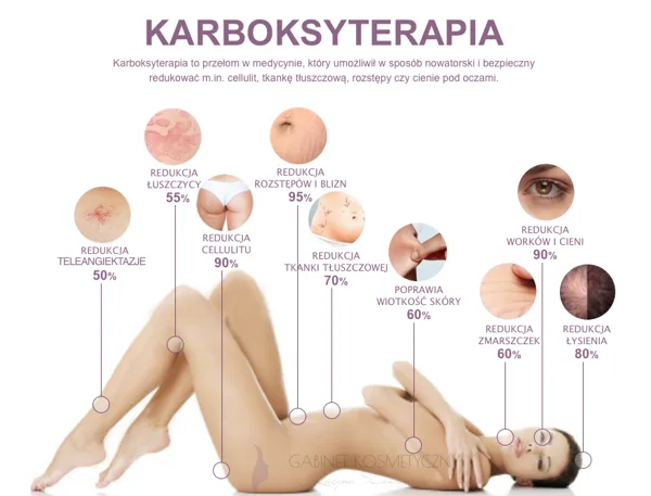 KARBOKSYTERAPIA
